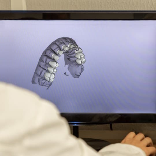 A digital scan of a patient's teeth on a monitor in the Soleil office