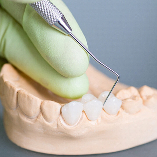 various types of dentures against a white background