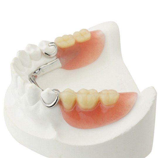 various types of dentures against a white background