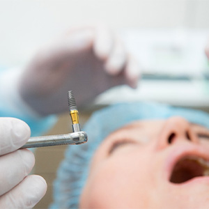Close-up of dental implant in Dallas being surgically placed