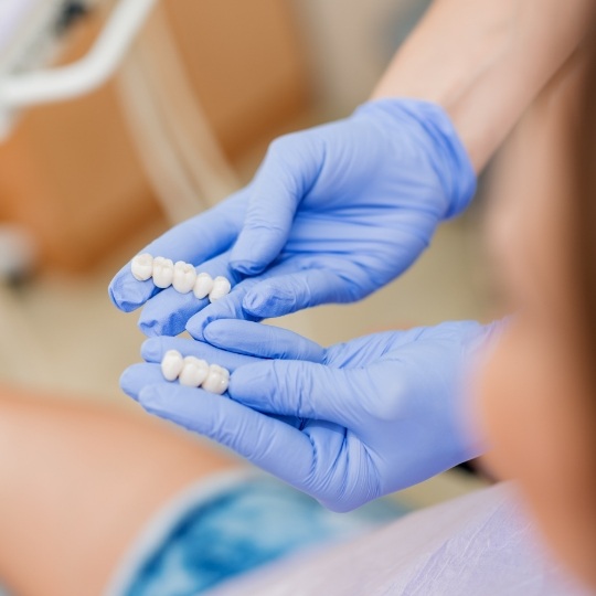 Dental team member showing patient two dental bridge options