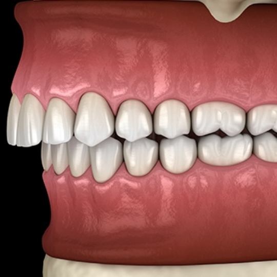 Animated smile showing common signs used in diagnosis