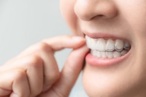 Nose down view of someone biting down on Invisalign over both rows of teeth while holding the top aligner with two fingers