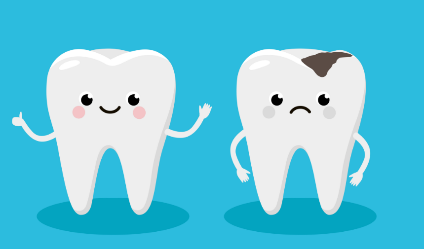 Cartoon of two teeth, one with a cavity