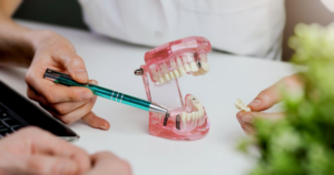 Dentist using a pen to point out dental implants on a clear plastic model