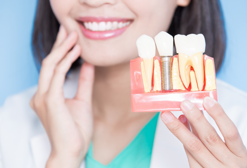 Woman holding dental implant mold